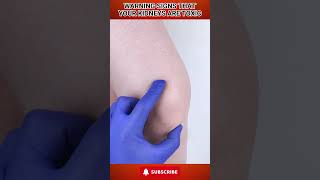 Warning Signs That Your Kidneys Are Toxic