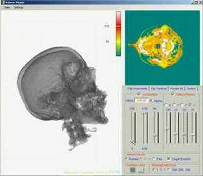 Volume Veiwer application