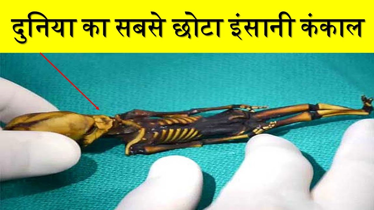 दुनिया का सबसे छोटा इंसानी कंकाल:The world's smallest human skeleton