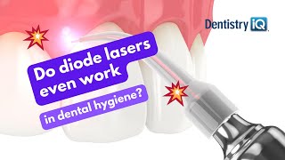 Do diode lasers even work in dental hygiene?