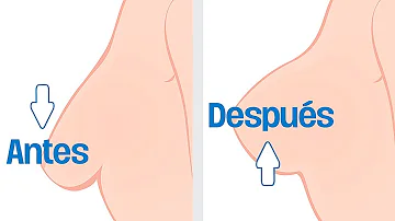 ¿Se puede llevar el mismo sujetador durante una semana?