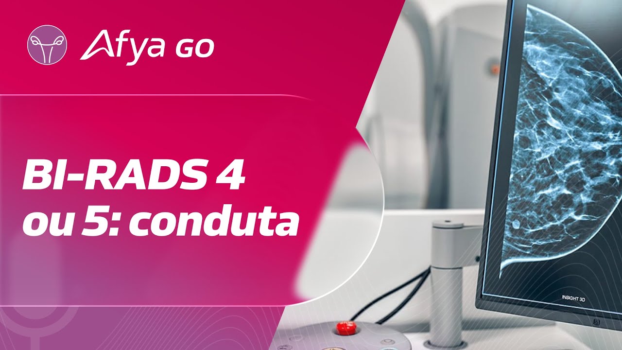 Como conduzir o primeiro atendimento após um exame com BI-RADS 4 ou 5 ...