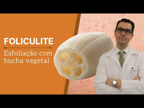 Vídeo: 4 maneiras de se livrar dos ovos de piolhos