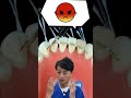 🦷前歯の歯並び🦷 #金歯先生 #歯医者 #dentist #歯科医師 #shorts #歯科矯正 #マウスピース矯正 #口臭 #ホワイトニング #歯石 #虫歯