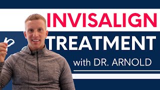 Smile makeover without drilling down teeth - Invisalign and composite bonding