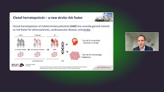 Clonal hematopoiesis of indeterminate potential as a novel risk factor for stroke