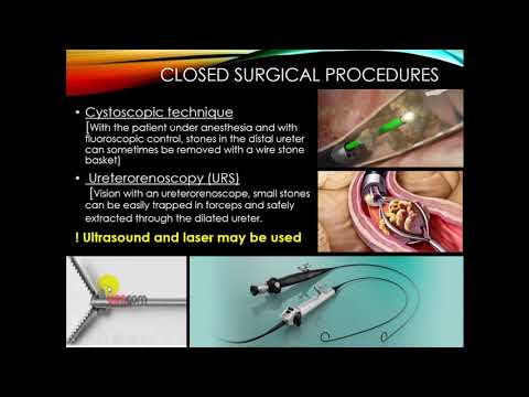 Nephrology  Urolithiasis Part 8