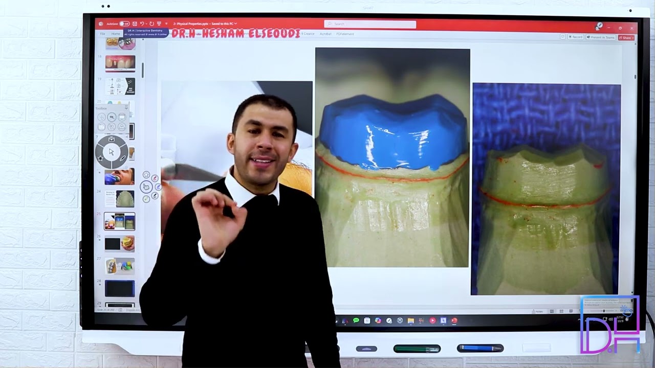 Dental Material 10- Why Dental Material Is Difficult P3 - فك ألغاز الدنتال ماتريال الجزء الثالث
