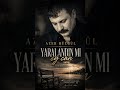 Azer Bülbül - Yaralandın mı Eycan Beat Fon Müzik