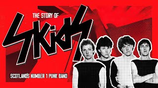 The Story Of Skids Scotlands No 1 Punk Band - Limited Edition Uk Blu-Ray Trailer