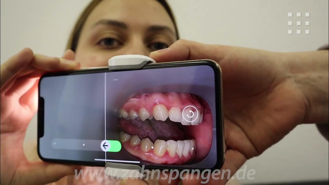 Erste Schritte mit der ScanBox Pro & Dental Monitoring YouTube