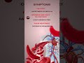 Iron deficiency #shorts #youtubeshorts