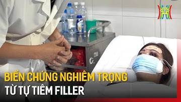 Biến chứng nghiêm trọng từ tự tiêm filler | Tin tức
