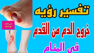 تفسير رؤيه خروج دم من القدم في المنام للعزباء والمتزوجه والمطلقة والرجل والحامل