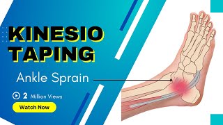 How to treat an Ankle Inversion Sprain - Kinesiology Taping to stabilise ligaments