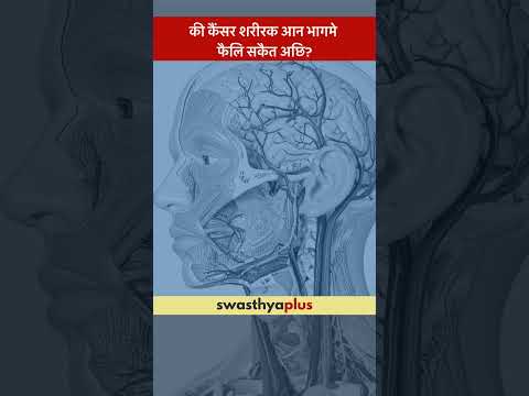 की कैंसर शरीरक आन भागमे फैलि सकैत अछि? | Can Cancer spread to other parts of the body? | Dr M C Jha