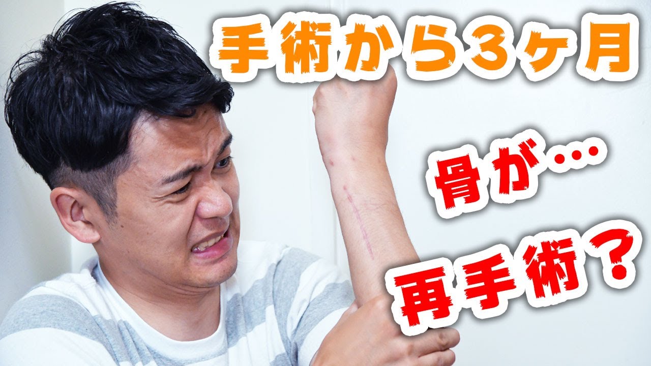 Tfcc損傷手術から3ヶ月 完治のはずが ボルダリングの怪我 Youtube