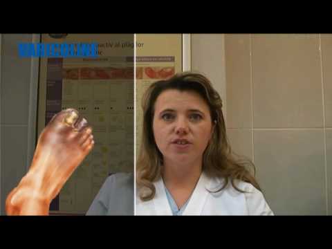 Video: Cum se tratează gangrena uscată (cu imagini)
