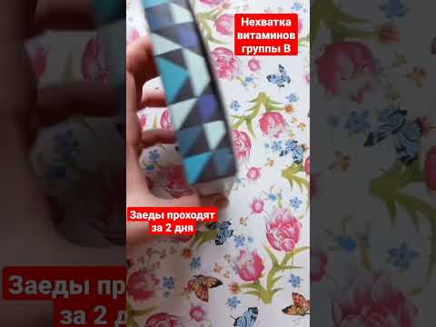 Заеды Трещины в уголках рта Дефицит витаминов группы В Витамины с кальцием Сибирское здоровье