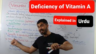 Deficiency Of  Vitamin A explained in Urdu by Dr Hadi