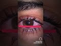 ويعيبوا فيا بتوع امبارح