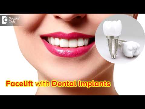 Can we give facelift in dental implants? - Dr. Deepa Jayashankar | Doctors' Circle