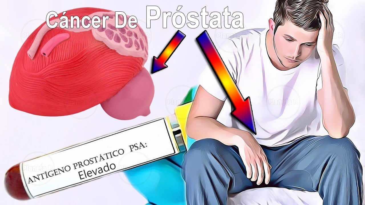 que es el mchc en analisis de sangre