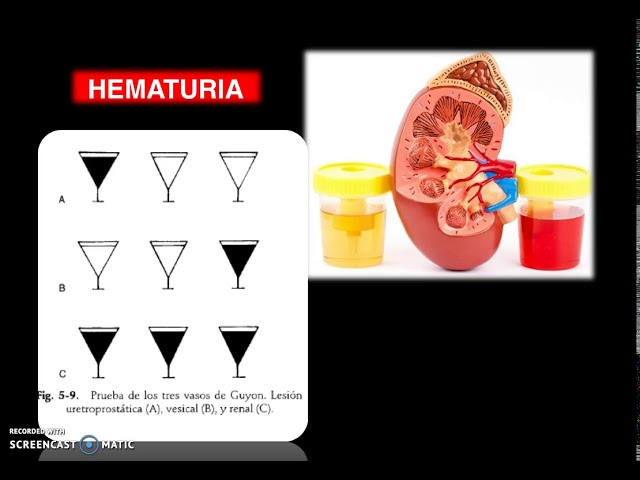 Volum urinar sau Diureza (urina)