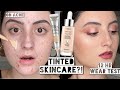 Best Makeup Day?? LOREAL TINTED HYALURONIC SERUM & EYECREAM ON ACNE | 10 Hour Wear Test