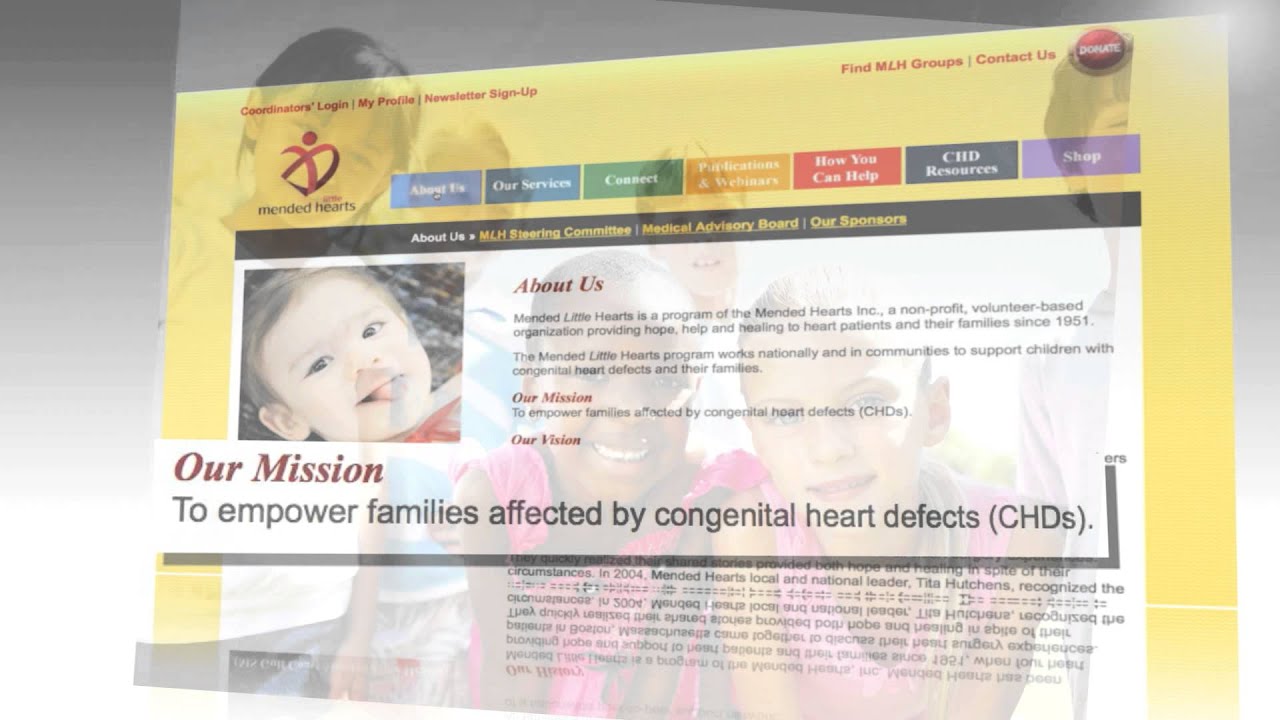 St  Jude Medical Max PSA 4 HD