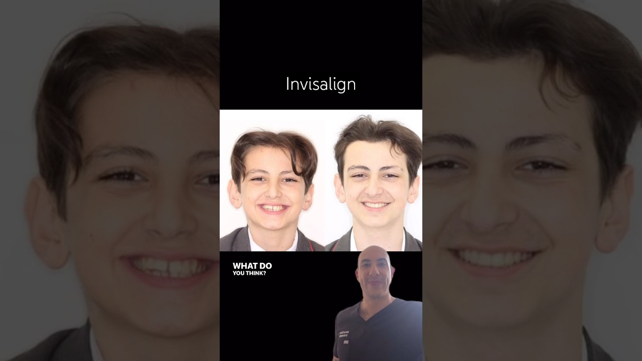 Invisalign with orthodontist Dr Ahmed Omran at DRMR Clinic 