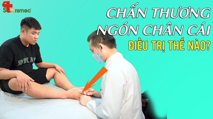 Chấn thương khớp ngón chân chữa như thế nào