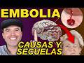 Embolia Cerebral: El Peligro de un Segundo Evento y Cómo Prevenirlo