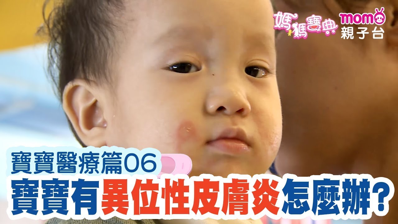 孩童異位性皮膚炎 中醫皮膚內服 飲食 外敷 根本治療 Dr Syuan宣草集中醫診所 乾癬異位性皮膚炎專家