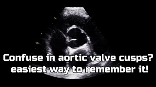 Aortic valve cusps : Label it in easiest way!