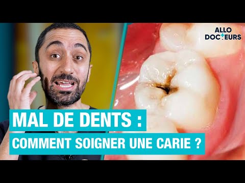 Vidéo: 3 façons de guérir les caries naturellement