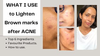 BEST Ingredients and PRODUCTS to LIGHTEN brown pigmentation AFTER ACNE | Acne Marks