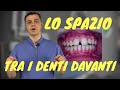 Gli spazi tra i denti davanti