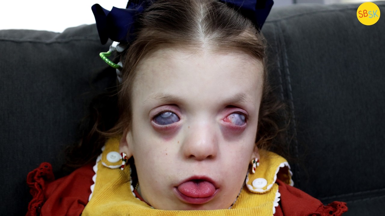 Семья, которая усыновила пятерых детей-инвалидов.