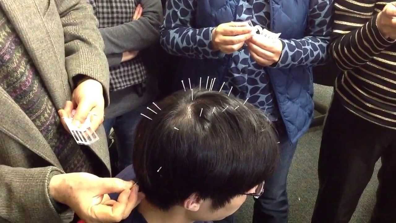 TCM head acupuncture class demo YouTube