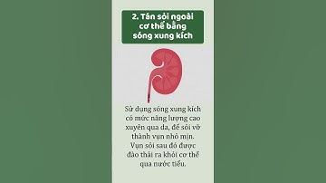 Điều trị sỏi niệu quản: Những thông tin cần biết #shorts