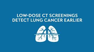 Cleveland Clinic Florida | Lung Cancer Screening