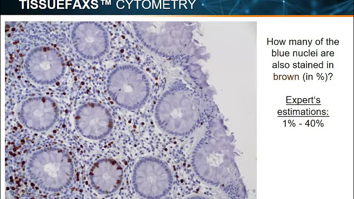 19 TissueGnostics - Deep learning for histological image classification