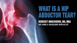 What is a Hip Abductor Tear | Trochanteric Pain Syndrome Treatment | Manhattan, New York, Brooklyn