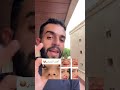 الانف اللحمي و البصلي تجميل الانف