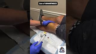 Comment for details 👇| Clinical case