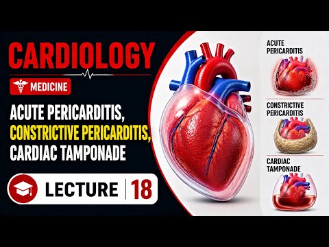 Cardiology Lecture 18 | Pericarditis ,Cardiac Tamponade & RCM |Integrated Medicine