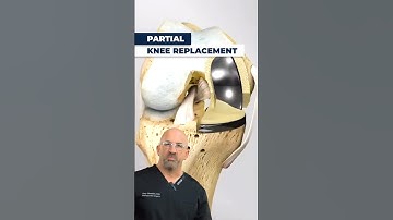 Is Partial Knee Replacement REALLY Right For You Now?