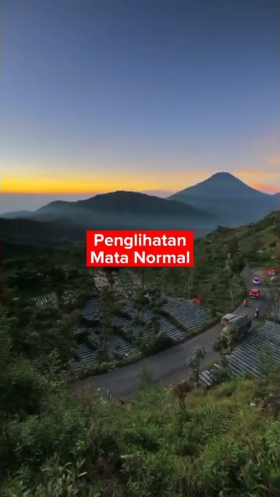 Bagaimana penglihatan Mata Katarak? | Klinik Mata EDC
