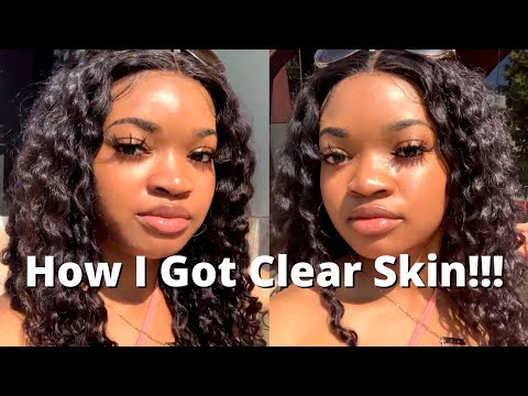 HOW I GOT CLEAR SKIN!!! // NO ACNE OR BREAKOUTS // FULL ROUTINE - YouTube